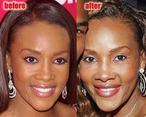 vivica fox breasts|Vivica Fox Before and After Plastic Surgery: Boob, .